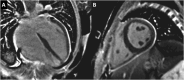 Fig. 24