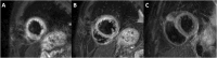 Fig. 43