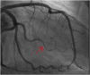 Fig. 49