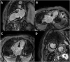 Fig. 44