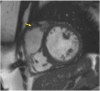 Fig. 31