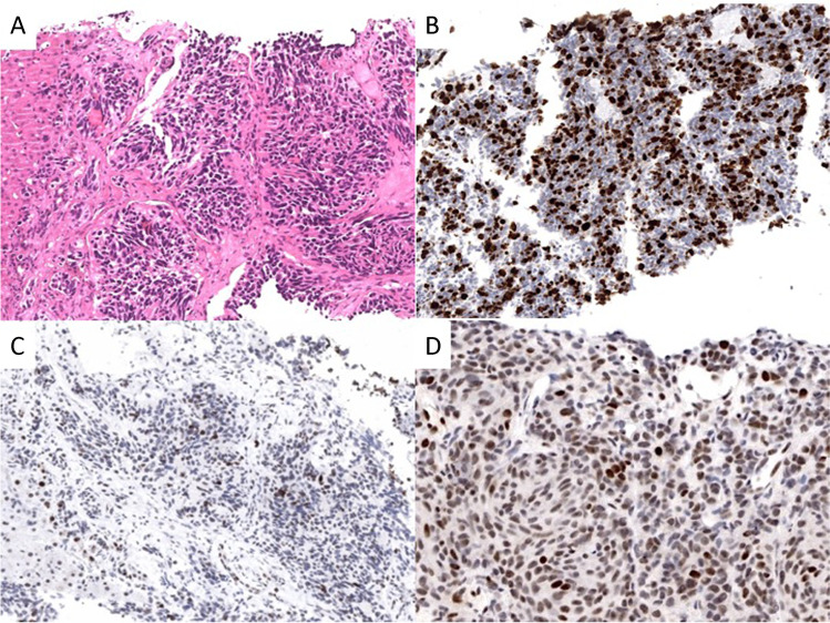 Fig. 2