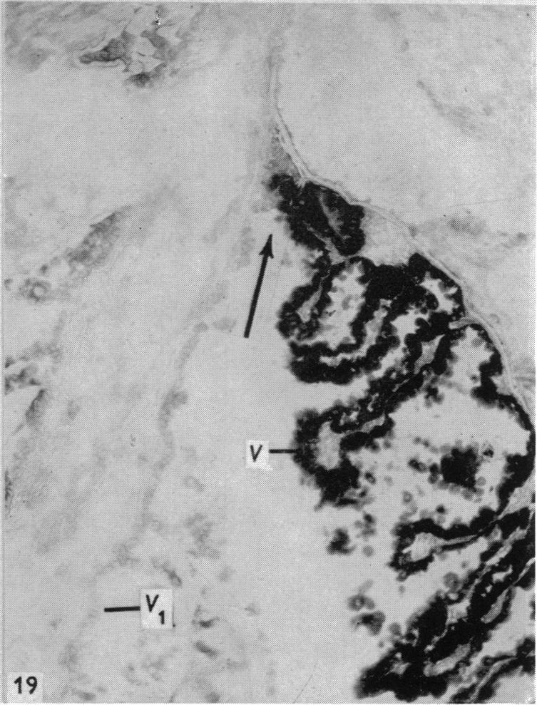 Fig. 19