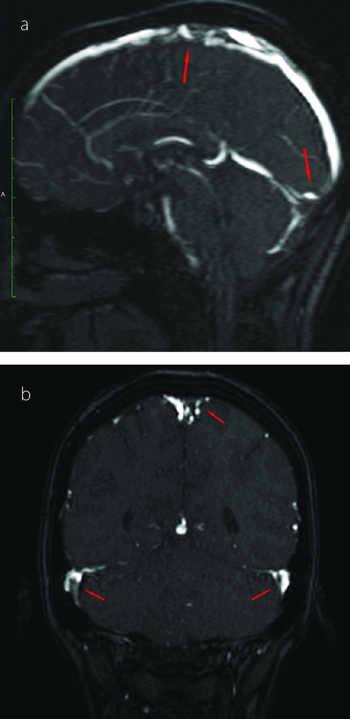 Figure 2 a, b