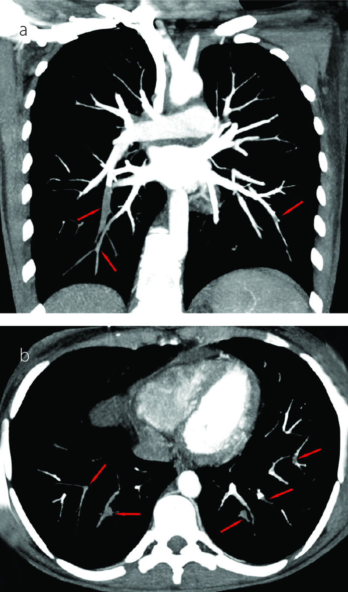 Figure 3 a, b