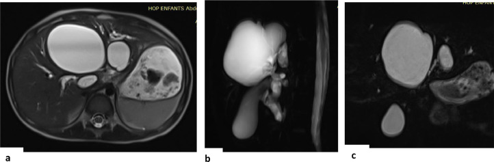 Fig 2: