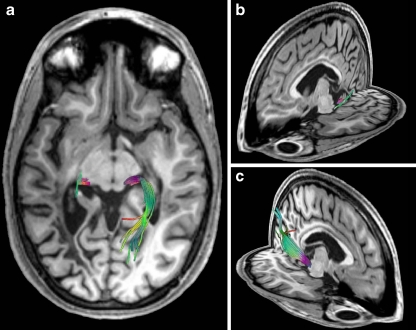 Fig. 4