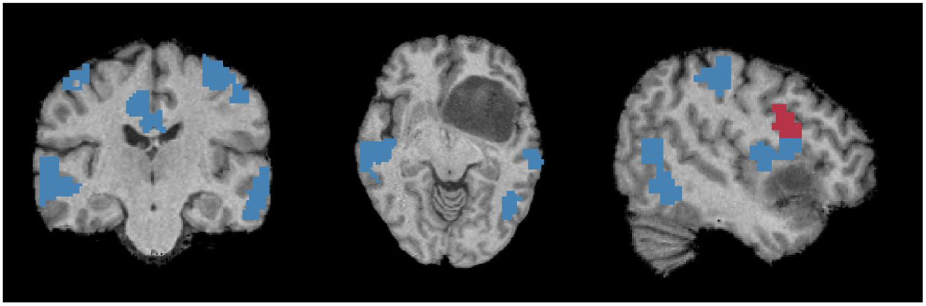 Figure 15: