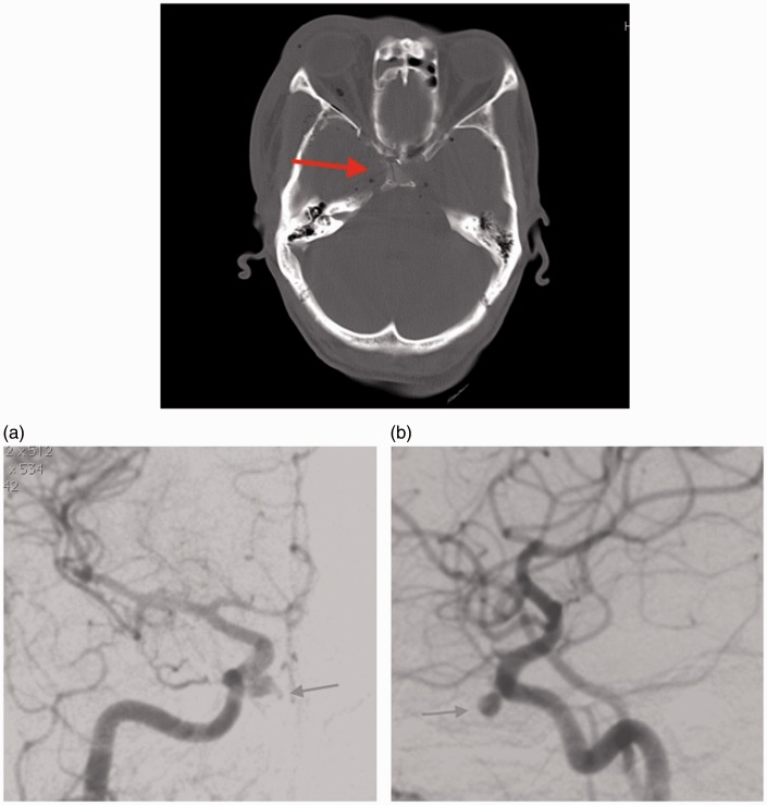 Figure 3.