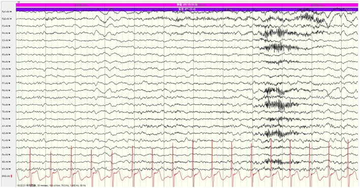 Figure 9