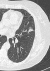Figure 1c: