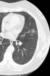 Figure 1a:
