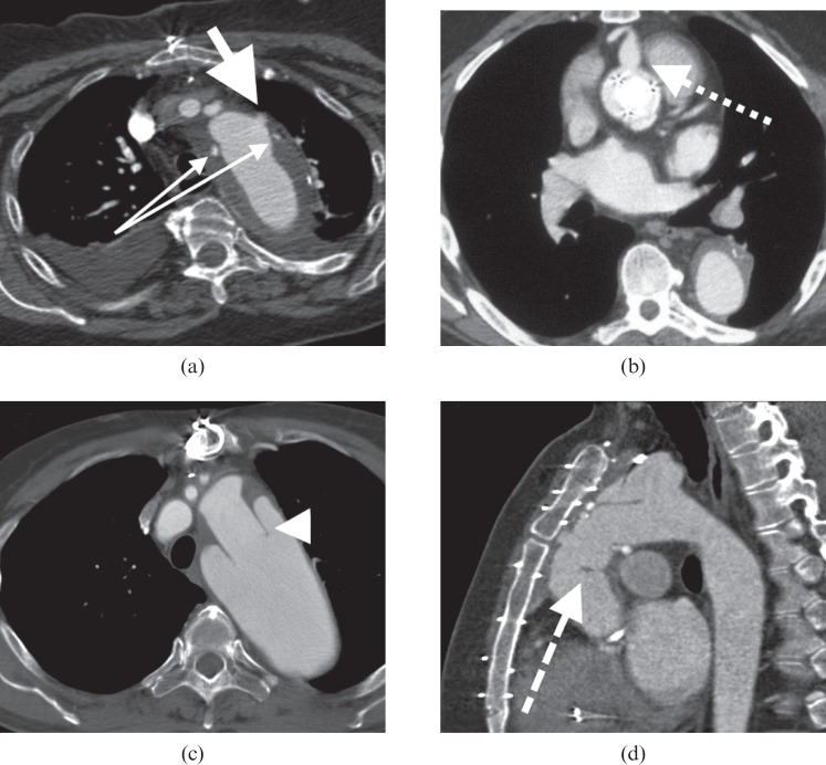 Figure 16