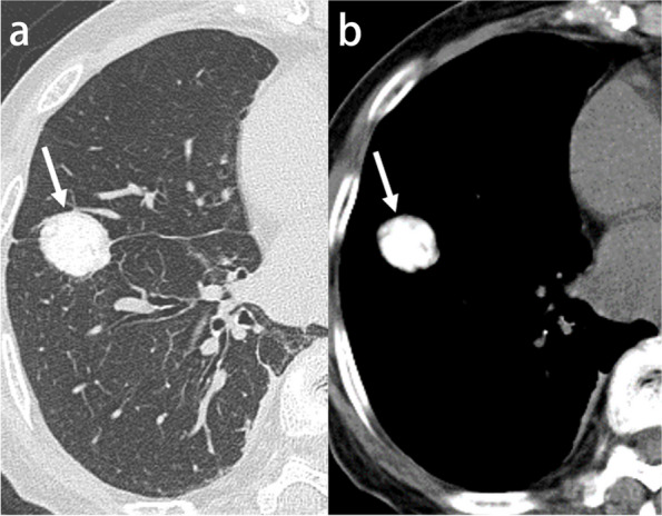 Fig. 15