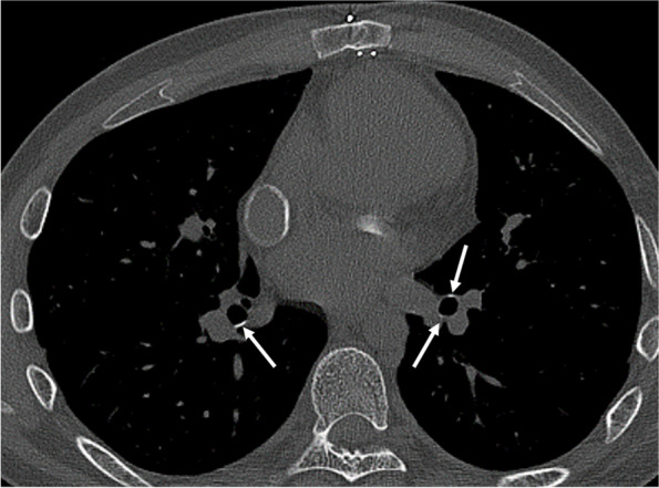 Fig. 16