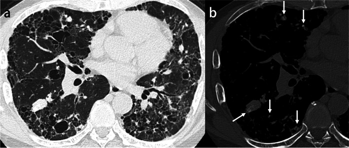 Fig. 6