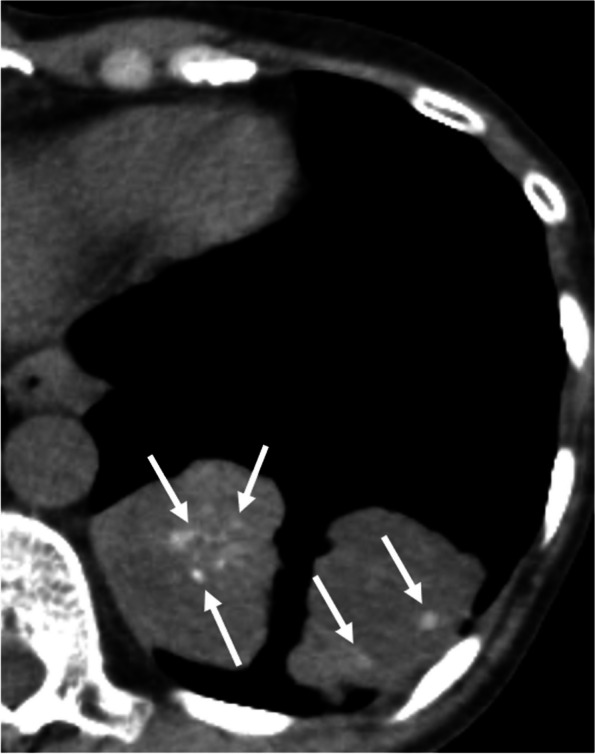 Fig. 5
