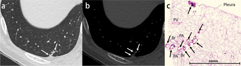 Fig. 12