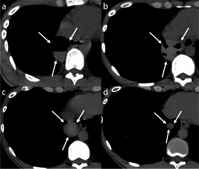Fig. 18