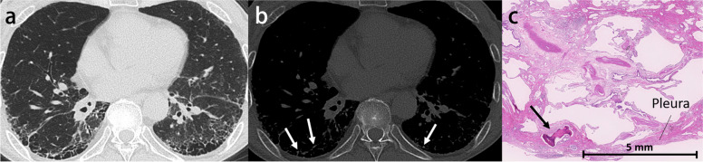 Fig. 13