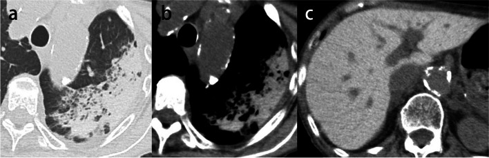 Fig. 17