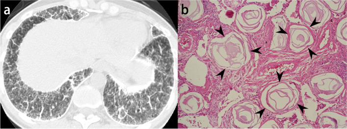 Fig. 11