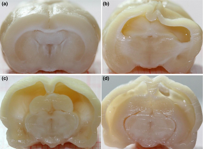 FIGURE 4