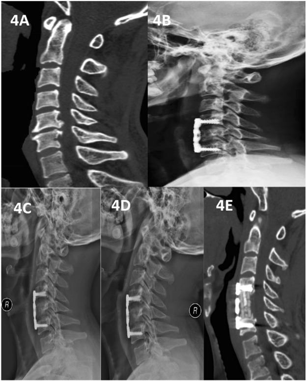 Figure 4