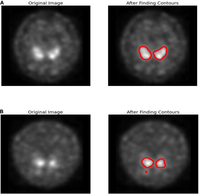 FIGURE 1