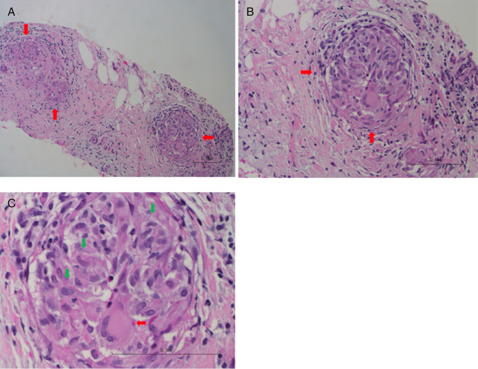 Figure 2.