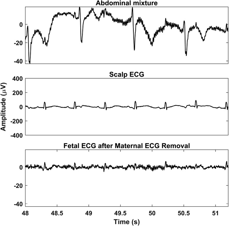 Fig. 4