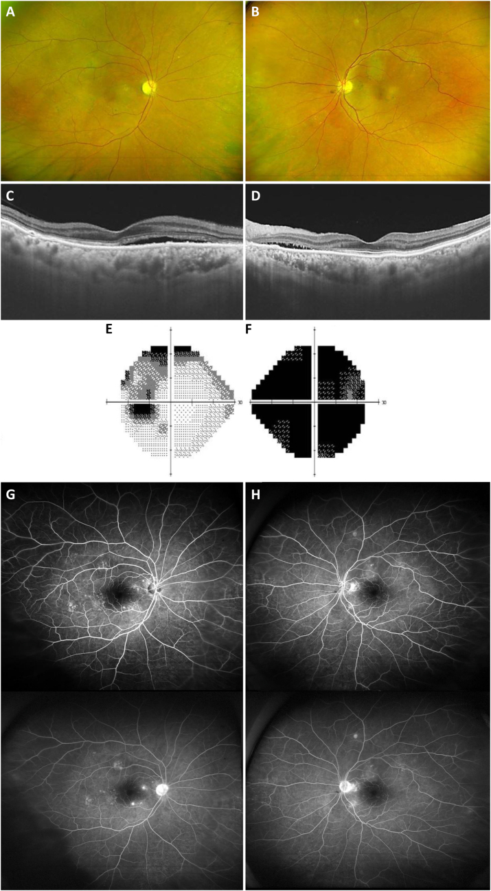 Fig. 3