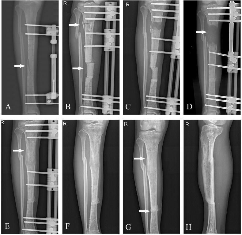 Figure 3