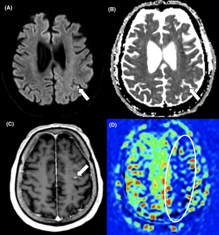 FIGURE 1