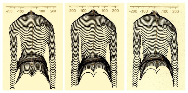 Figure 20