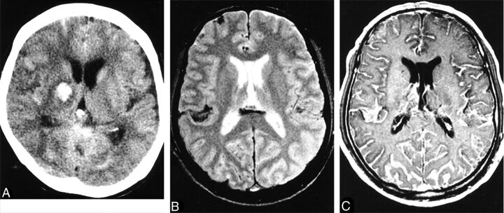 Fig 1.