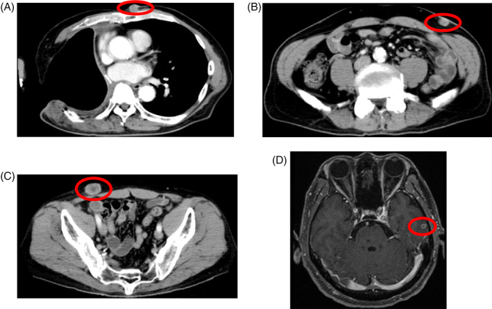 FIGURE 2