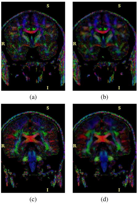 Fig. 18