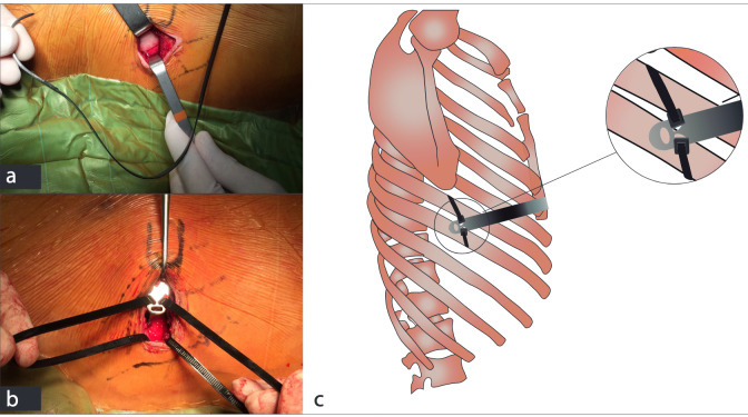 Fig. 9