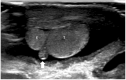 Fig. 19