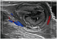 Fig. 18