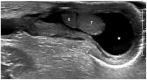 Fig. 10