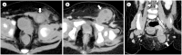 Fig. 14