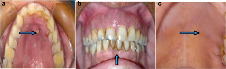 Fig. 1