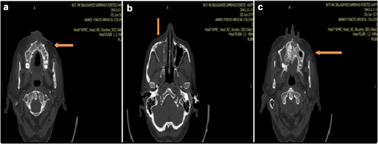 Fig. 2