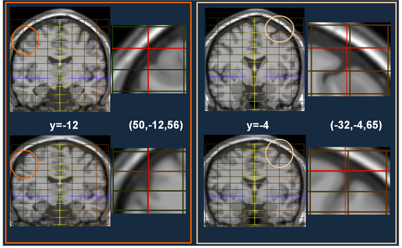 Fig. 10