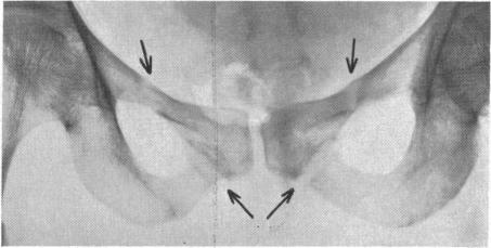 Fig. 3B