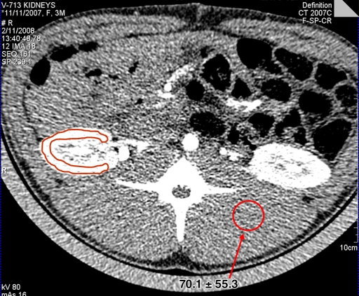 Figure 1b: