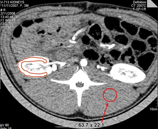 Figure 1c: