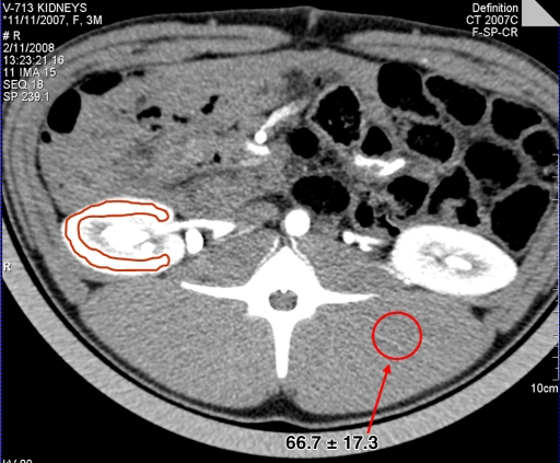 Figure 1a: